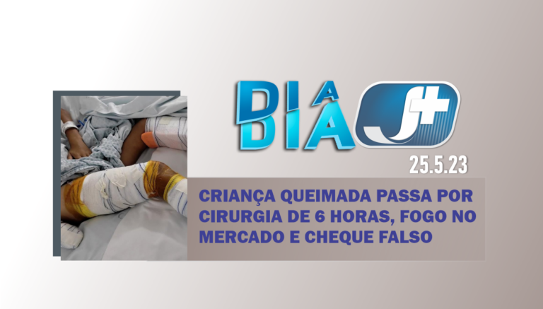 Criança queimada passa por cirurgia de seis horas, fogo no mercado e cheque falso em Canoinhas